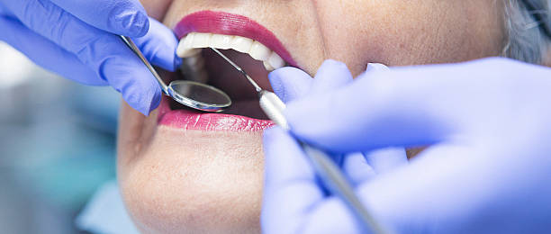 Best Knocked-Out Tooth (Avulsed Tooth) Treatment in Morgantown, PA